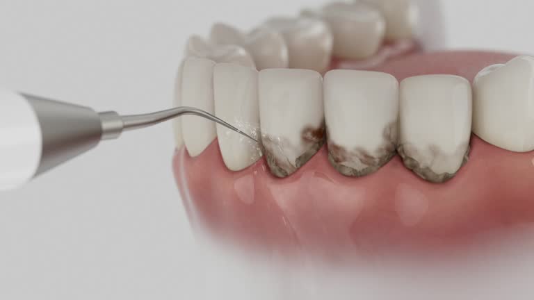 Trusted Emergency Dentist service in Itasca, TX - Dentist Open Now